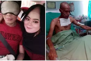 Kisah setia sang istri merawat suami yang kulit tubuhnya mengelupas