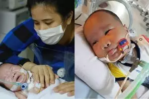 Potret perjuangan bayi dengan penyakit kompleks ini akan sentuh hatimu