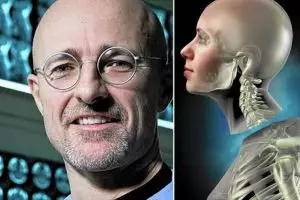Sukses transplantasi kepala mayat, dokter ini coba pada kepala manusia