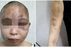 Diduga selingkuh, wanita ini dianiaya dan digunduli suaminya