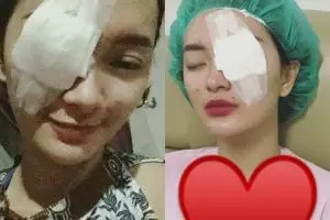 Mata kiri Zaskia Gotik diperban habis operasi, sakit apa ya?