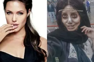 Gadis ini ingin mirip Angelina Jolie, malah berakhir seperti zombie