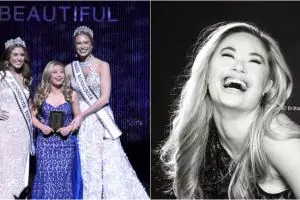 Penderita down syndrome ini sukses cetak sejarah di kontes kecantikan