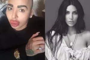 Ingin mirip sang idola, 4 orang ini malah terlihat seram usai oplas