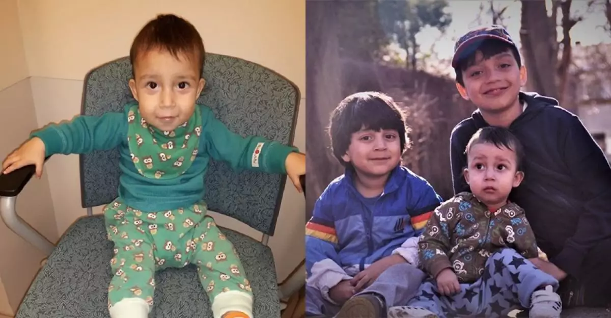 Alergi terhadap makanan, anak ini hanya bisa makan buah langka ini