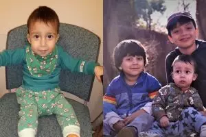 Alergi terhadap makanan, anak ini hanya bisa makan buah langka ini