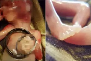 Kisah pilu wanita unggah foto janinnya usai keguguran