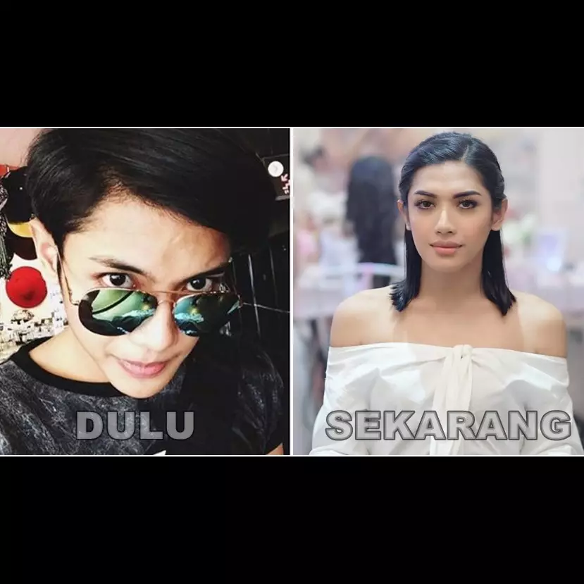 Nggak cuma Millen, 5 artis ini dulu ganteng kini penampilannya cantik