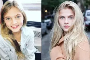 10 Pesona Skylar Dunn, pemeran Charity muda film The Greatest Showman