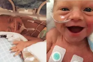 13 Potret bayi prematur yang tersenyum lebar ini bukti mereka kuat