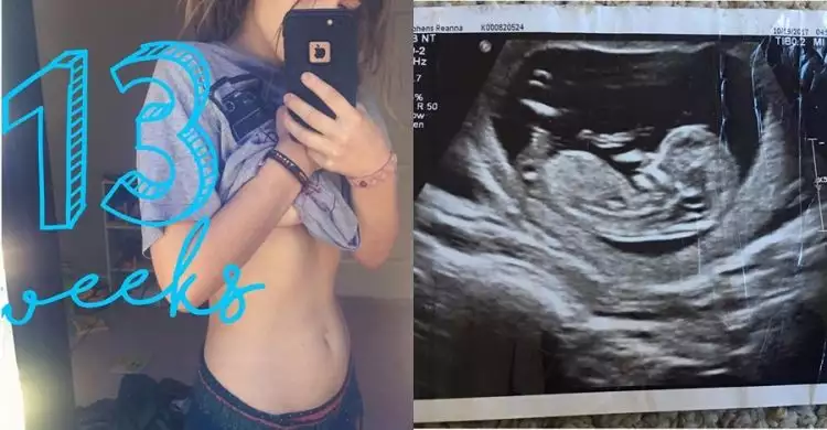 7 Potret Reanna, cewek yang tetap langsing meski hamil 7 bulan