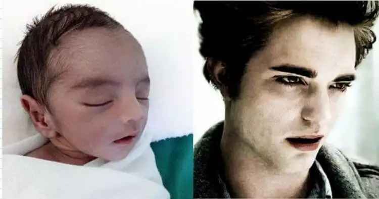 Usai baby Arsya, kini heboh bayi ganteng yang mirip Robert Pattinson