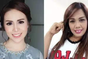 4 Seleb ini punya pengalaman dihujat karena bentuk giginya