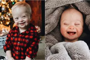 10 Potret Case, bayi penderita down syndrome yang ngegemesin banget