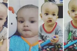 Wajahnya kaku sebelah, bayi ini kesakitan jika tersenyum