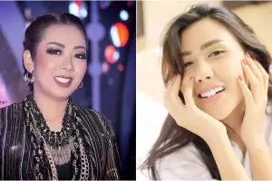 Demi gigi putih, 5 seleb cantik ini rela habiskan ratusan juta