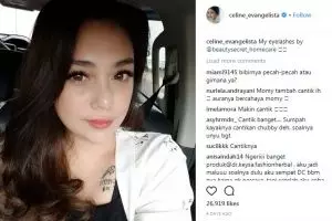 Pamer foto close up, bibir Celine Evangelista jadi sorotan warganet