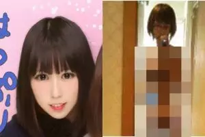 Tak diberi makan kakeknya, kondisi tubuh wanita ini memprihatinkan