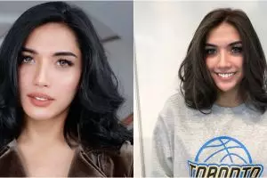 Unggahan foto terbaru Millendaru bikin warganet kasihan, ada apa?