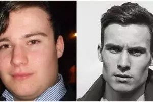 Perubahan 15 'itik buruk rupa' jadi  memukau ini bikin melongo