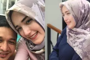 Disebut oplas, ini 10 potret Adelia istri Pasha yang berhidung mancung