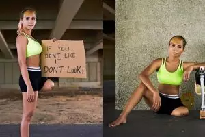 Relakan satu kakinya diamputasi, keinginan wanita ini malah terwujud