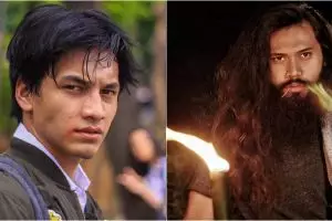 Punya image bad boy, 7 seleb ganteng ini ternyata takut jarum suntik