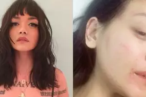 Curhatan model cantik Dylan Sada, alami pelecehan hingga babak belur