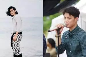 Biasa tampil dengan kacamata, 6 seleb ini hilangkan minus pakai lasik