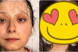 Transformasi makeup 8 orang miliki kekurangan di wajah ini bikin kagum