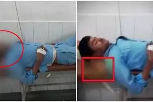 Perawat rumah sakit ini pakai potongan kaki pasien buat bantal tidur