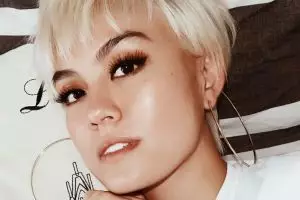 Demi penampilan, ini foto Agnez Mo perawatan di dokter seleb Hollywood