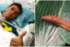 Pria ini koma 420 hari gara-gara nekat telan bekicot hidup