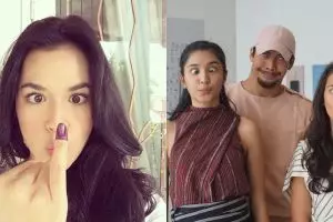 Berpose mata juling, 8 seleb ini tetap terlihat cantik memesona