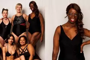 10 Pemotretan ini kampanyekan perbedaan fisik itu bukan masalah