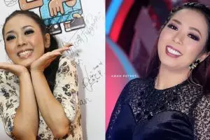 11 Penampilan seleb sebelum dan sesudah veneer gigi, senyumnya beda