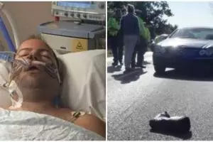 Kecelakaan lalu lintas paling parah, bikin 47 tulang pria ini patah