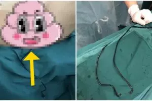 Alat kelamin pria ini harus dioperasi gara-gara kabel charger HP