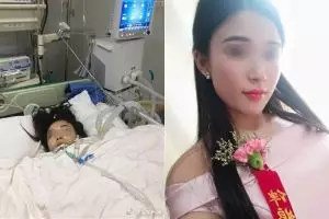 Jadi bridesmaid 2 hari berturut-turut, kaki cewek ini harus diamputasi