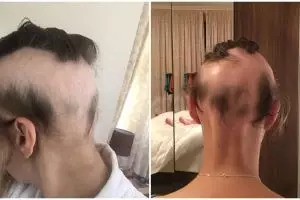 Stres jelang pernikahan, perubahan rambut wanita ini sungguh drastis