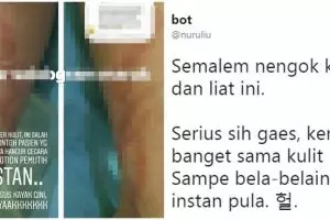 Kisah ngeri wanita kulitnya rusak usai pakai lotion pemutih