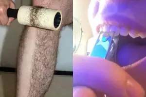 Dijamin nggak tenang melihat 10 foto ini, bikin ngilu banget