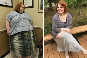 Transformasi 15 orang obesitas turunkan berat badan ini bikin melongo