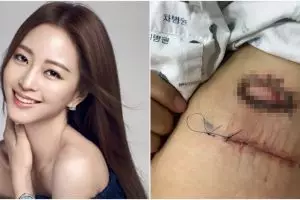 10 Gaya Han Ye-seul, aktris Korea yang sempat jadi korban malapraktik