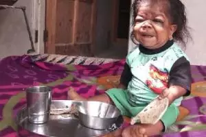 Terlihat seperti anak balita, ternyata usia laki-laki ini bikin syok