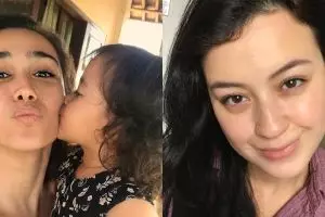 Tak biasa, 5 seleb cantik ini justru berani pamer flek hitam di wajah