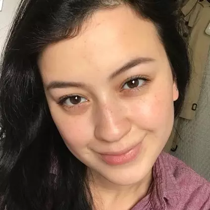 Tak biasa, 5 seleb cantik ini justru berani pamer flek hitam di wajah