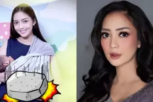 Gendong anaknya, kondisi tangan Ririn Dwi Ariyanti ini dibilang seram