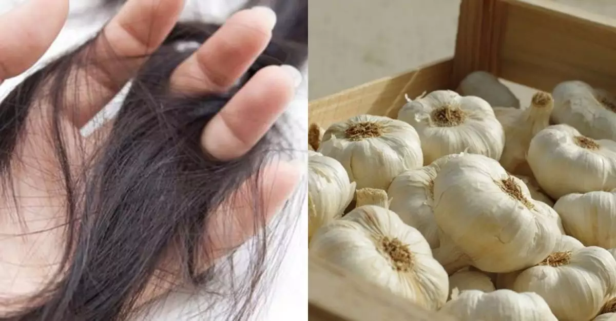 Penemuan menakjubkan! Bawang putih ternyata ampuh atasi rambut rontok
