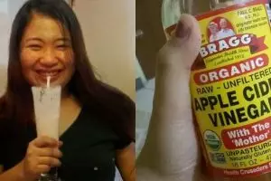 10 Pesona Donie Lin, cewek yang hits setelah sukses diet dengan cuka